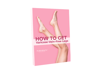 How to Get Varicose<br> Vein-Free Legs Converted